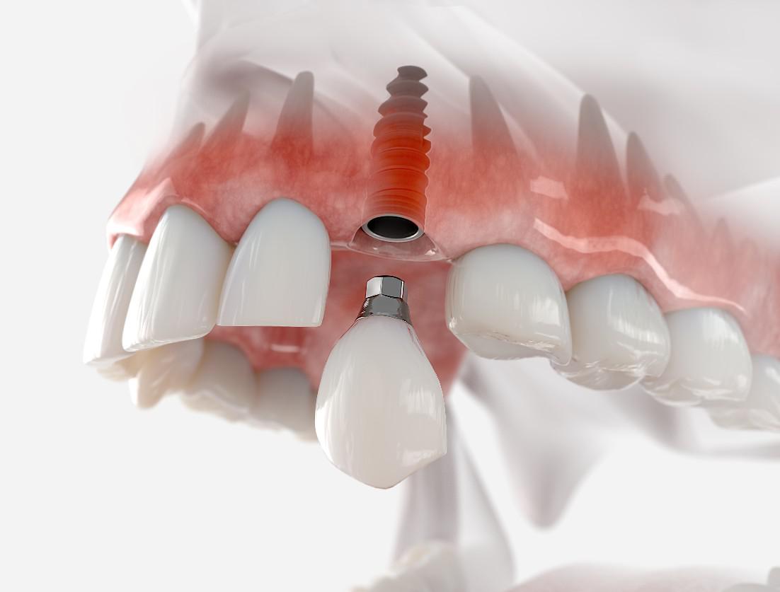 Innovative Dental Treatments Transforming Patient Care